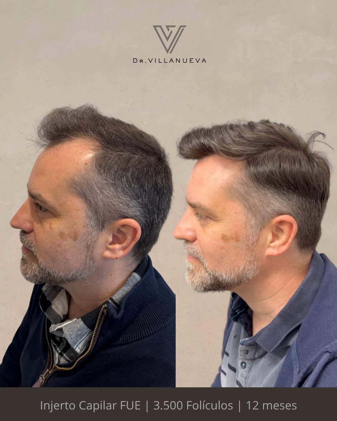 Alfredo Villanueva-4