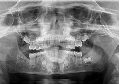 Catharina Zantner-13