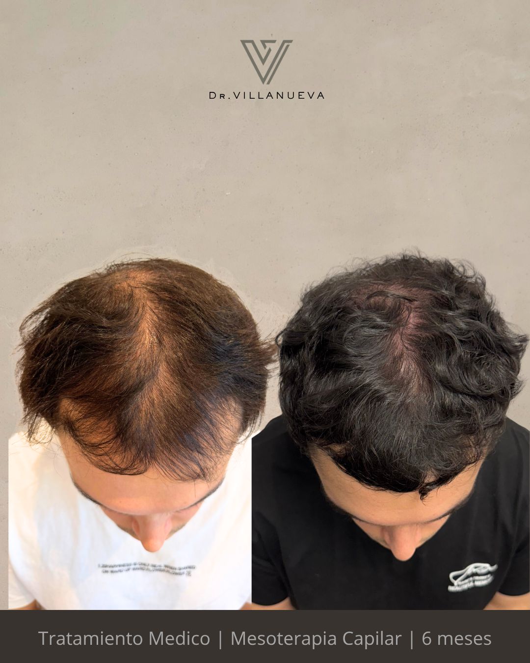 Alfredo Villanueva-13