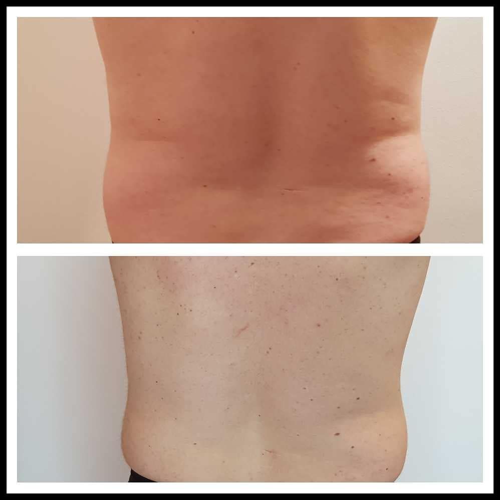 Rosalba Herrero Zerpa-370