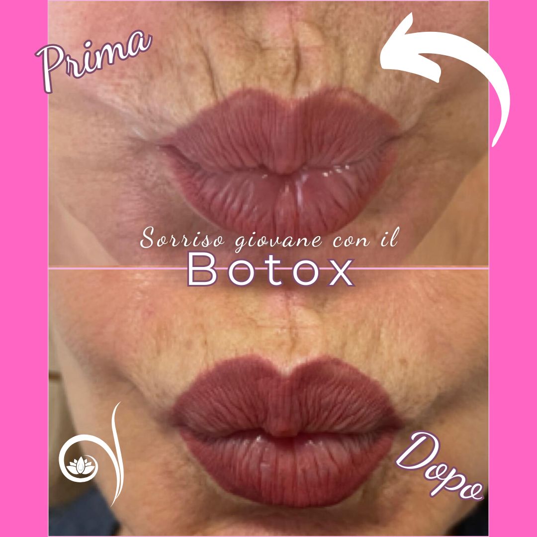 Vittoria Cassioli-14