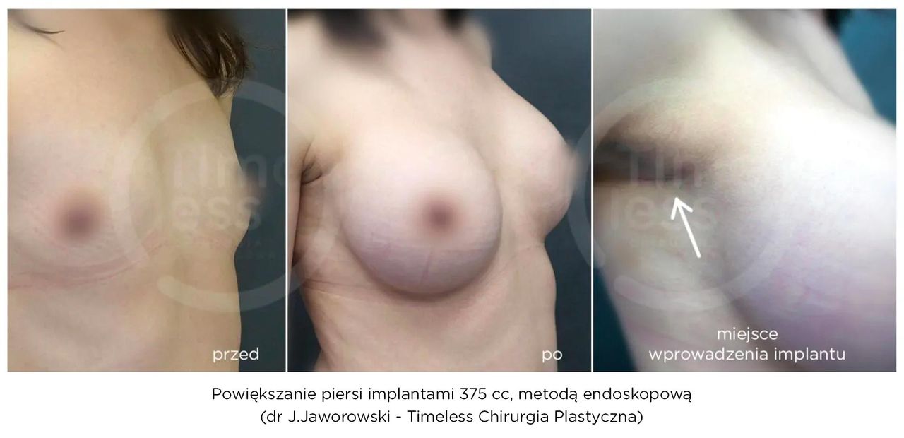 Janusz Jaworowski-122