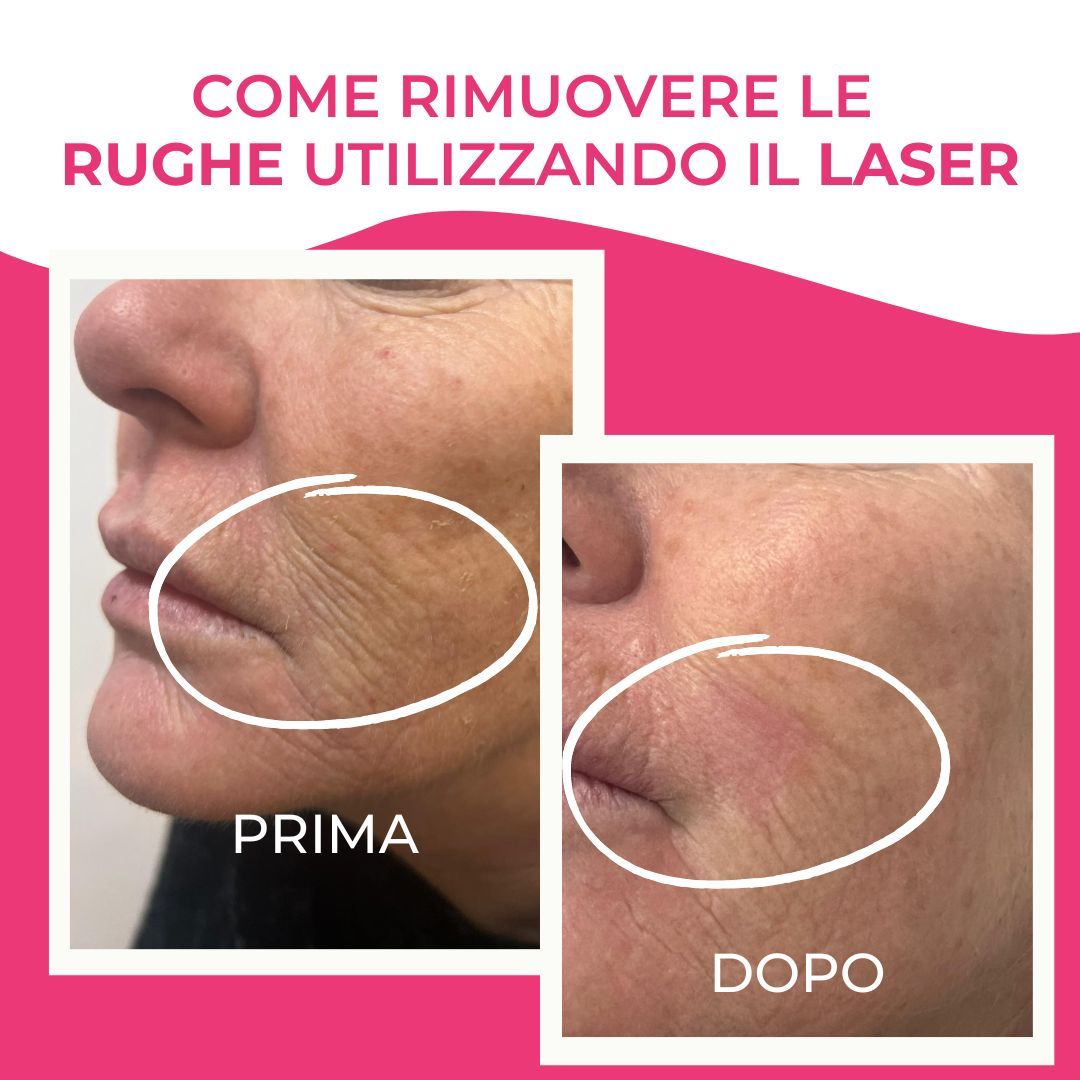 Francesca De Razza-78