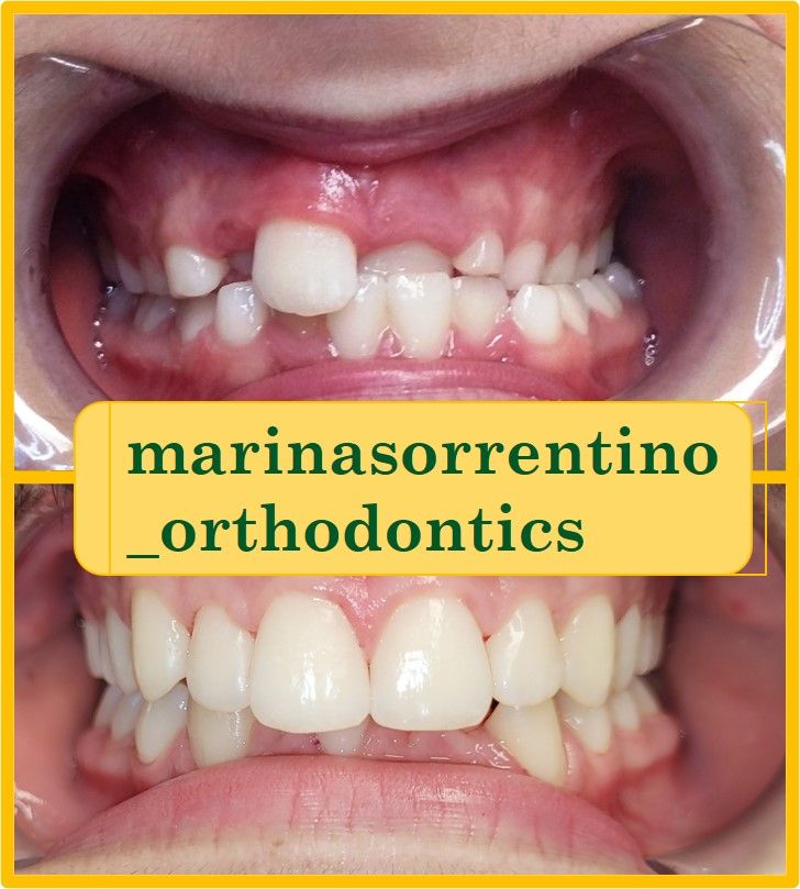 Marina Sorrentino-21