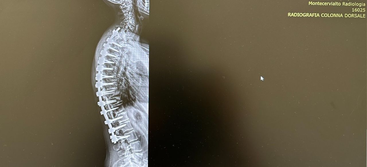 Valerio Cipolloni-24