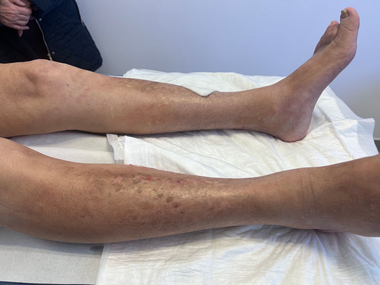 Luciano Allegretti-26