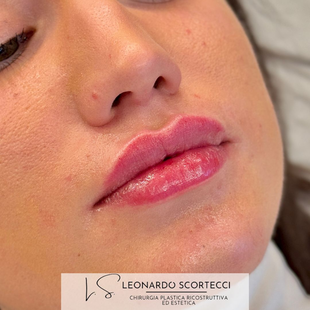 Leonardo Scortecci-6