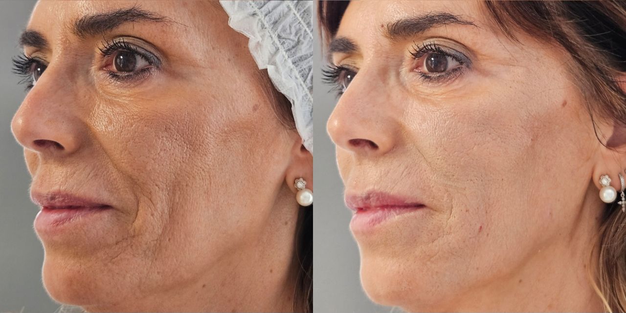 Rosalba Herrero Zerpa-37