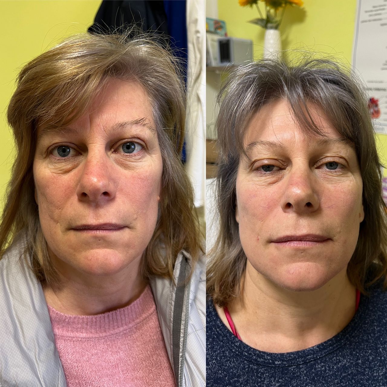 Jacopo Pettinelli-47