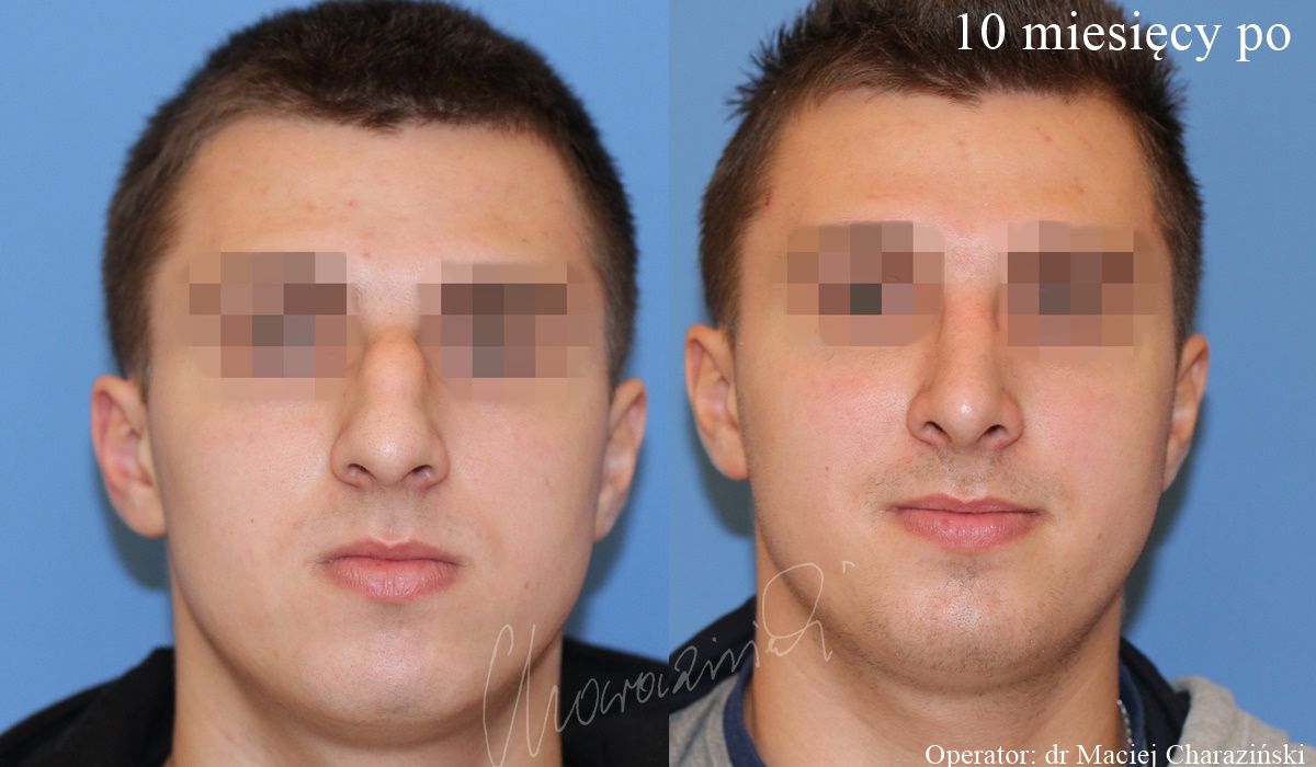 Maciej Charaziński-38