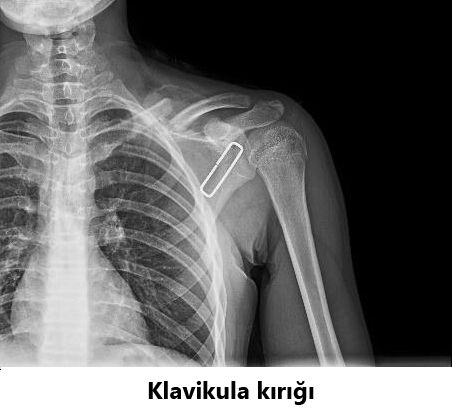 Javid M. Azarabadı-14