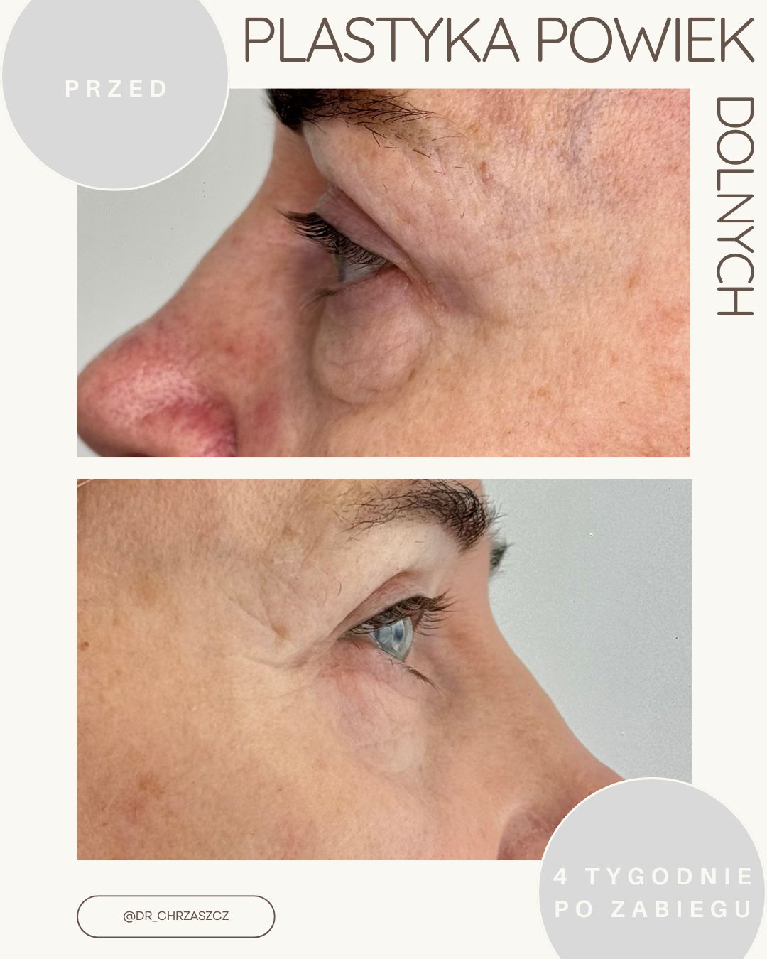 Michał Chrząszcz-13