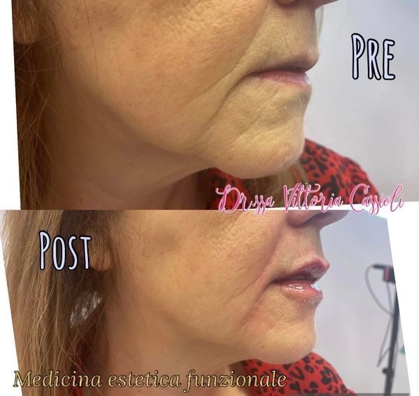 Vittoria Cassioli-19