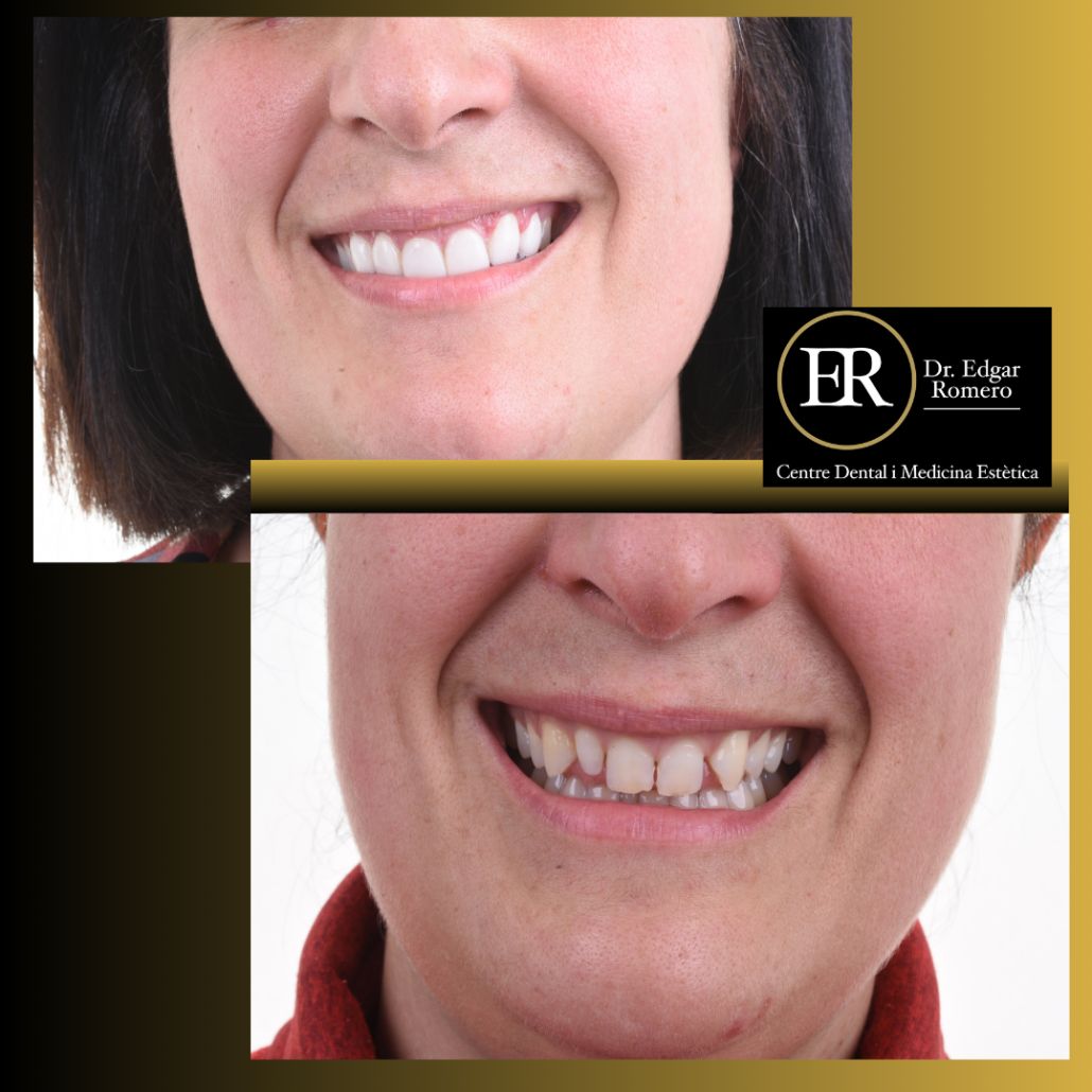 Edgar Teddy Romero Pelaez-0