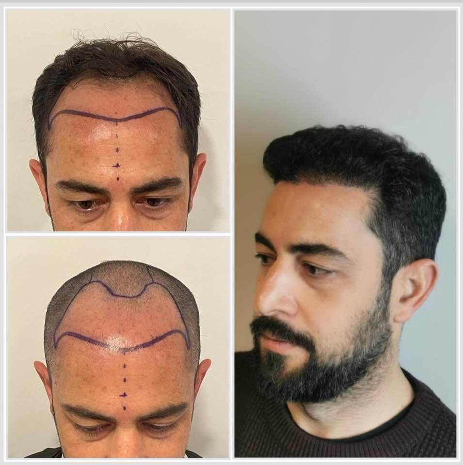 Fabrizio Barattolo-17