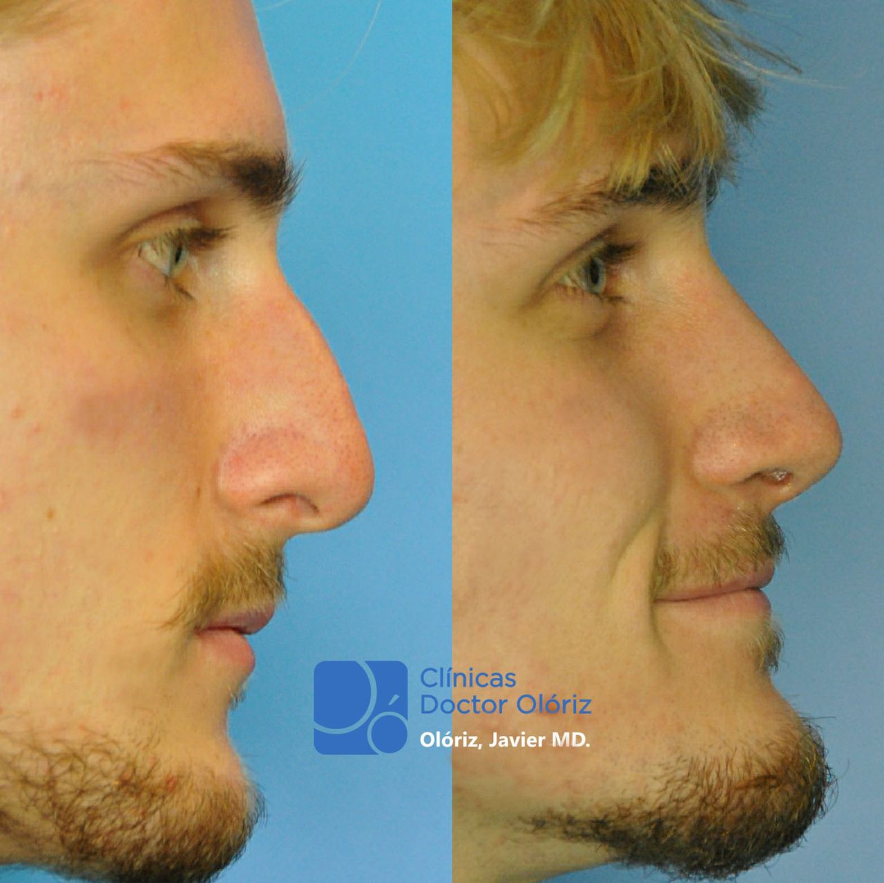 Javier Oloriz Marin-4