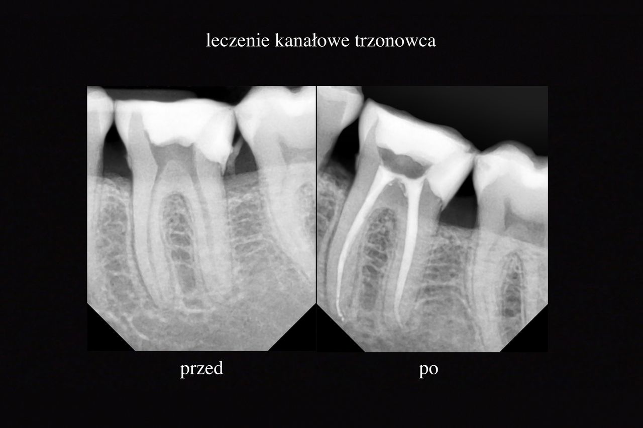 Grzegorz Wójcicki-5