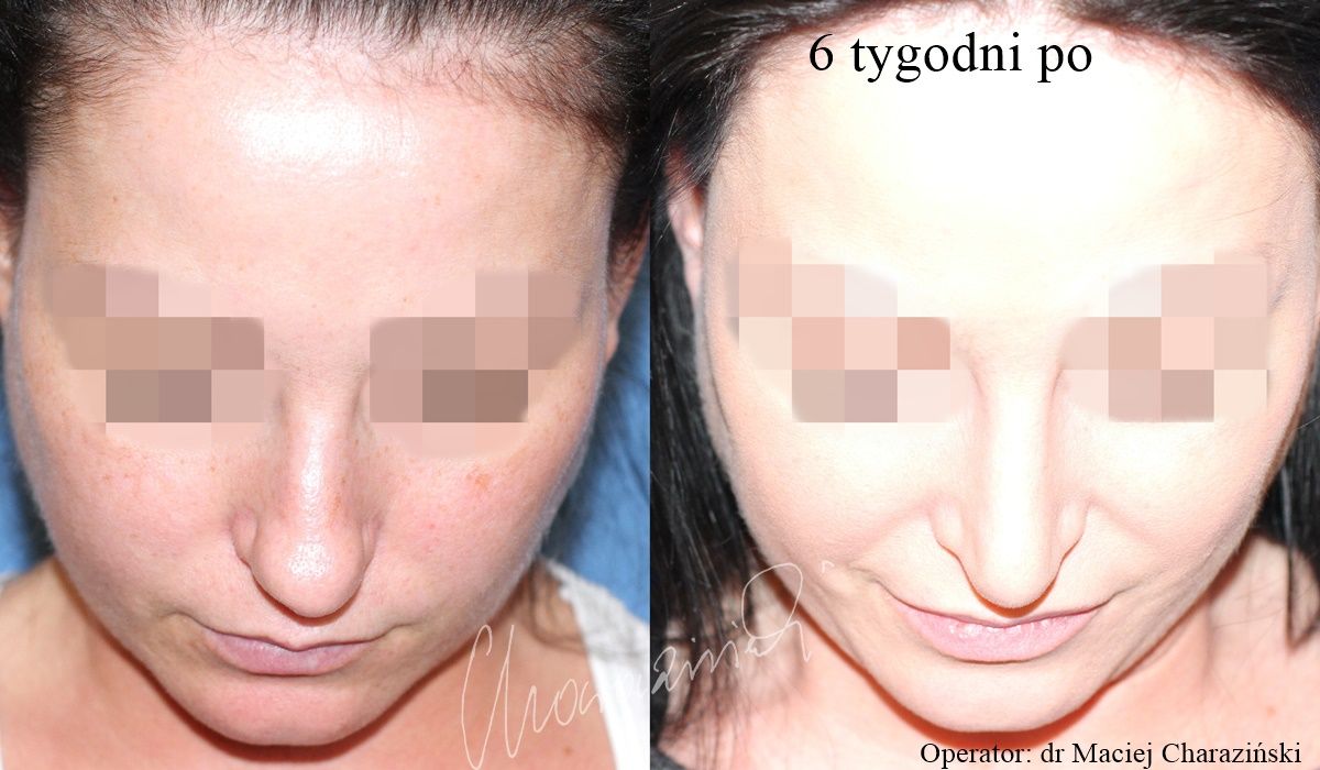 Maciej Charaziński-85