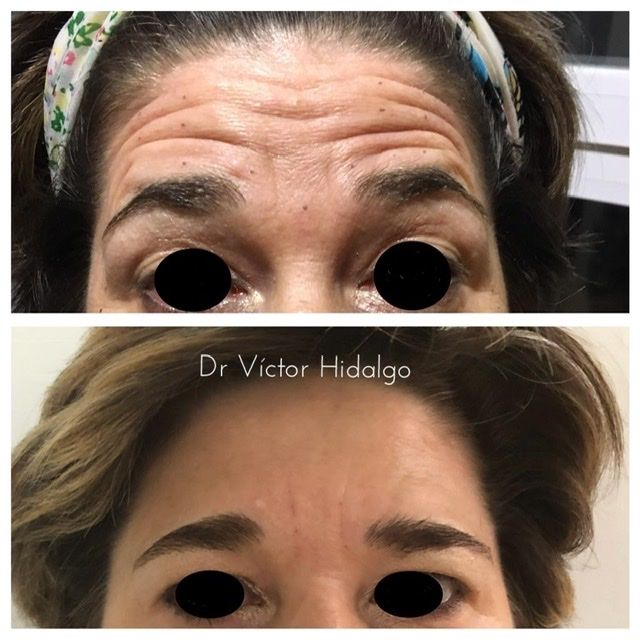 Víctor Hidalgo López-5