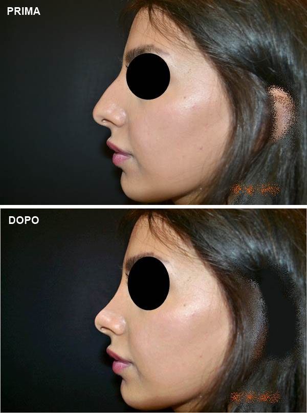 Pasquale Virciglio-29