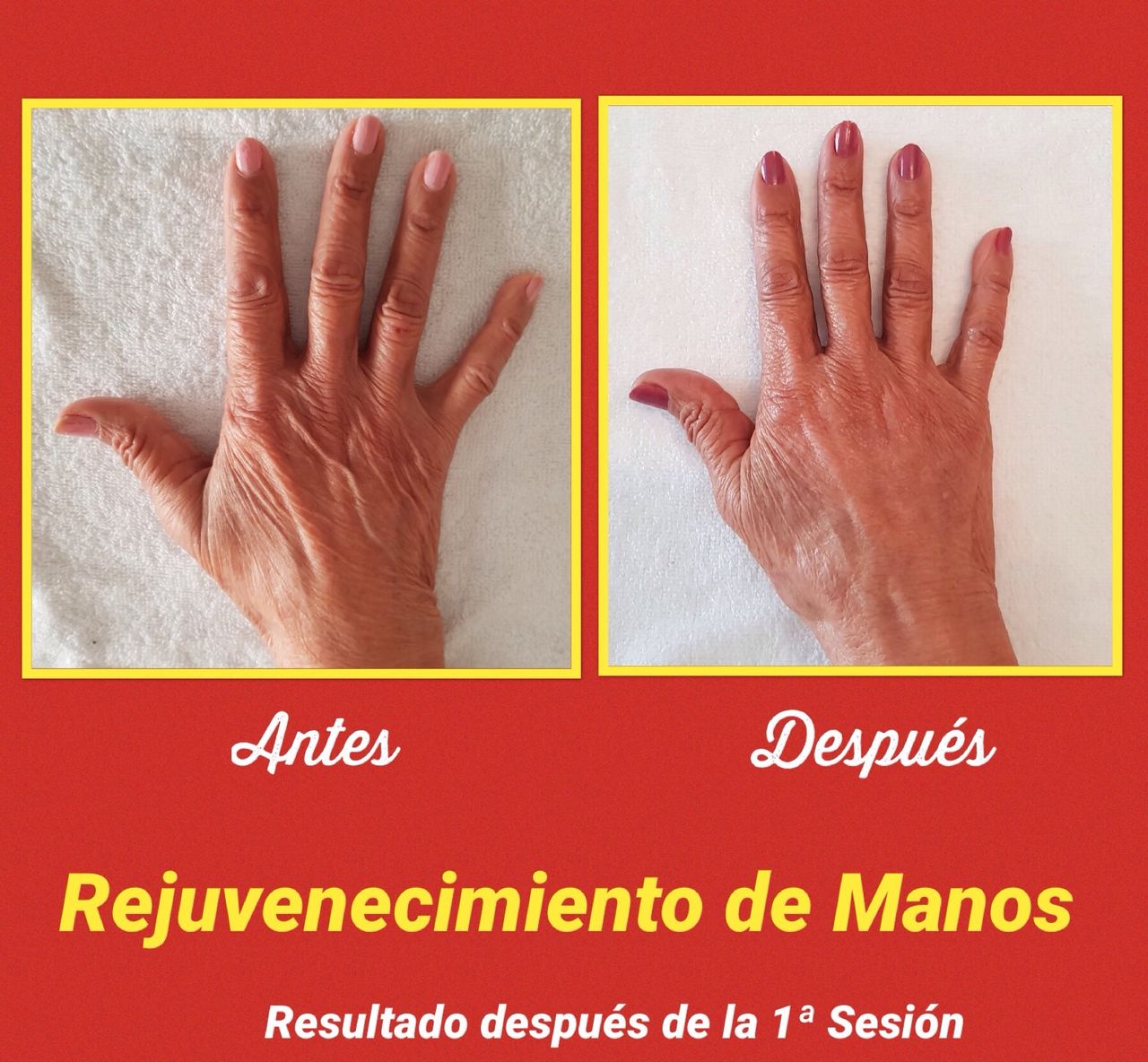 Rosalba Herrero Zerpa-419