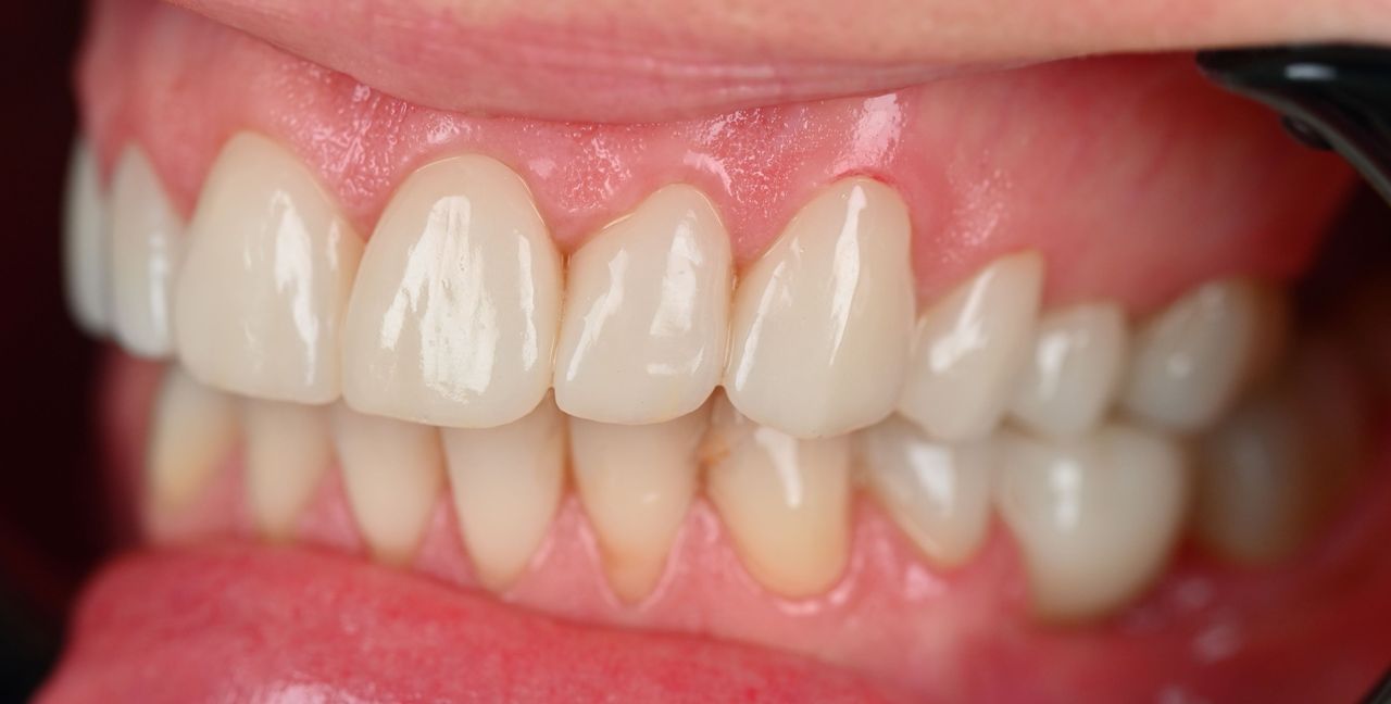 Magdalena Bińkowska-8