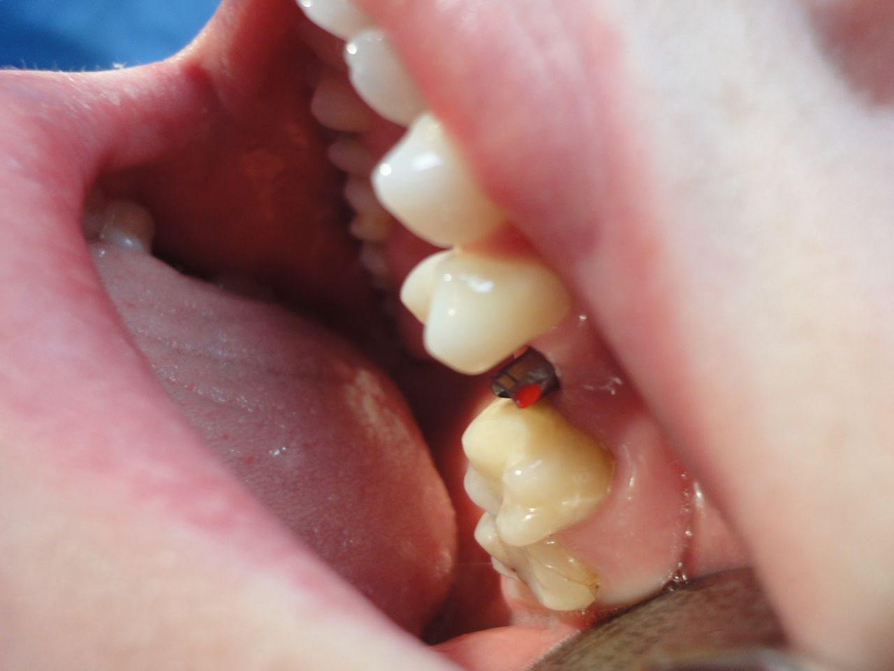 Krzysztof Zieliński-19