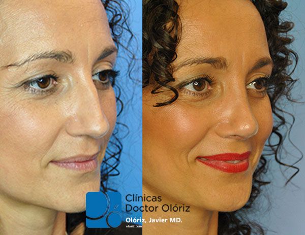 Javier Oloriz Marin-9