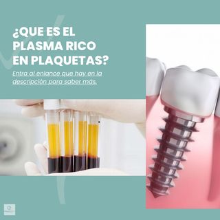 Odontoesthetic. Dr.Villarreal