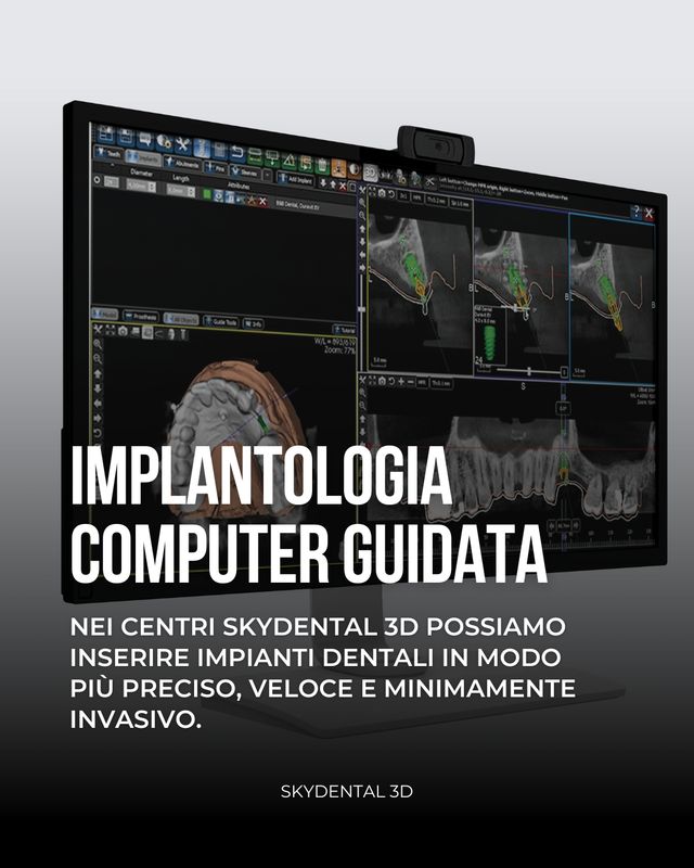 Ingrandire l'immagine: 