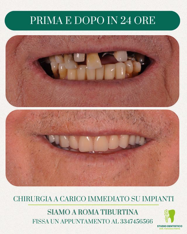 Ingrandire l'immagine: 