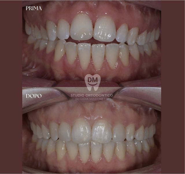 Ingrandire l'immagine: 