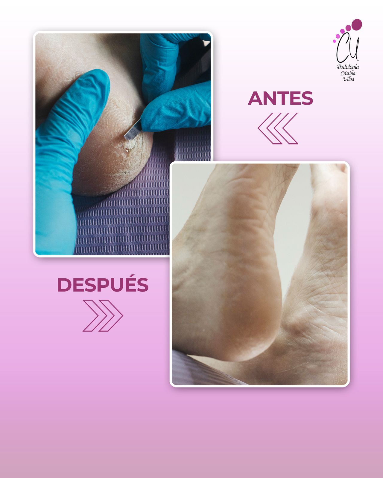 -0
